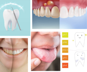 Proven benefits of neem for teeth—backed by science