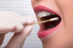 Oil Pulling Recipe to Reverse Cavities Naturally: A Step-by-Step Guide