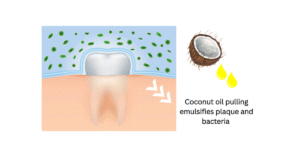 Diagram showing how oil pulling emulsifies and removes plaque for whiter teeth
