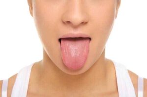 get rid of dry mouth after oil pulling