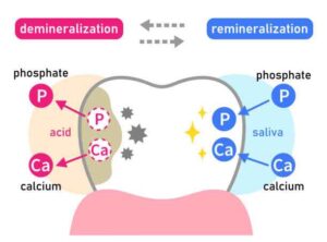 diagram showing how tooth remineralization repairs enamel