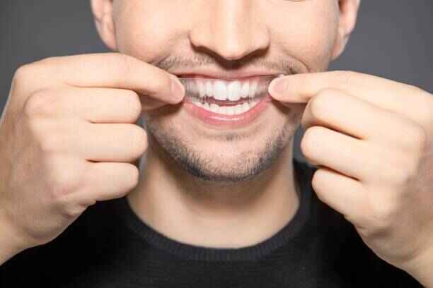 teeth whitening strips for white teeth