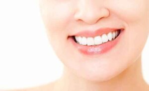 natural teeth whitening
