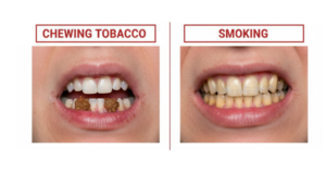 Chewing Tobacco vs. Smoking