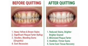 just generate image of Smokers Teeth Before and After Quitting