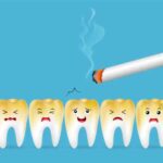 How smoking affects teeth and gums