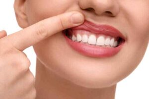 essential minerals to Strengthen Teeth and Gums