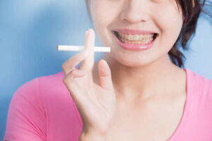 Smoking Affect Teeth
